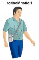 Illustrasjon av en mann iført en Holter monitor