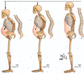 Hvordan ryggraden komprimerer med alderen