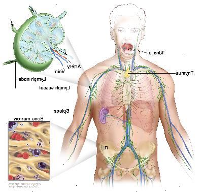 Lymfesystemet, tegning viser lymfeårer og lymfeknuter organer, inkludert lymfeknuter, mandlene, thymus, milt og benmarg. En innfelt viser innsiden strukturen av en lymfeknute og de vedlagte lymfekar med piler som viser hvordan lymfe (klar væske) beveger seg inn og ut av lymfeknute. En annen innsatt viser et nærbilde av benmarg med blodceller.