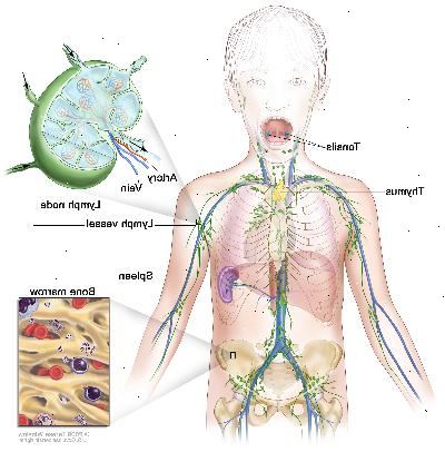 Lymfesystemet, tegning viser lymfeårer og lymfeknuter organer, inkludert lymfeknuter, mandlene, thymus, milt og benmarg. En innfelt viser innsiden strukturen av en lymfeknute og de vedlagte lymfekar med piler som viser hvordan lymfe (klar væske) beveger seg inn og ut av lymfeknute. En annen innsatt viser et nærbilde av benmarg med blodceller.