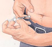 Pasient sprøyte insulin i magen