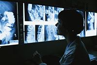 Bilde av en lege ser barium klyster x-ray filmer