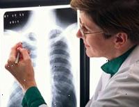 Bilde av en kvinnelig radiolog lese en x-ray