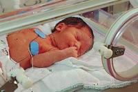 Bilde av en baby i neonatal intensive care unit