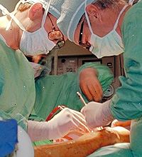 Bilde av kneet kirurgi