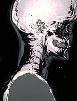 Et bilde av et røntgenbilde av hodet