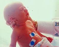 Bilde av en nyfødt i neonatal intensive care unit
