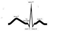 Illustrasjon av en grunnleggende EKG tracing