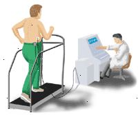 Illustrasjon som viser en arbeids-EKG
