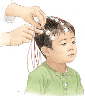 Under en EEG, er elektroder plassert på barnets hodebunnen slik at den elektriske aktiviteten i hjernen kan bli registrert.