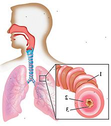 Omrisset av menneskelig hode og brystet med hodet vendt til side som viser innsiden av nese, svelg og luftrør som fører til lungene i brystet. Nærbilde av luftveis viser strammet muskler, hovne slimhinnen, og økt slim.